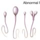 abnormal-sperm اسپرم HOMEOPATHY دکتر جلال میرعبداله طب هومیوپاتی IRANHOMEOPATHYMEDICINE.COM
