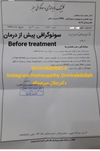 poly cystic ovary , homeopathy تخمدان پلی کیستیک درمان هومیوپاتی Drmirabdollah.ir