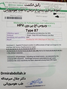 درمان زگیل انگشت ناخن طب هومیوپاتی homeopathy wart papiloma virus